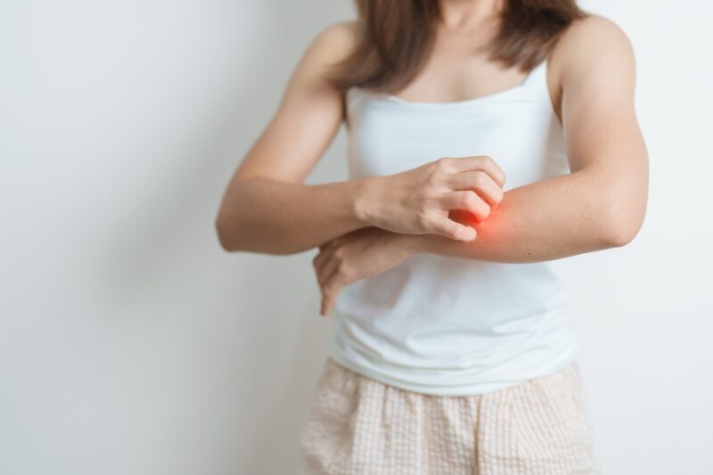 Lupus Eritematoso Sistemico assistenza